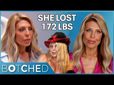 Christina Lost 172 Pounds and Her Boob Job Ruined Her Confidence All Over Again | Botched | E!