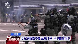 香港示威 傳1記者疑被橡膠子彈擊中眼部 20190929 公視晚間新聞