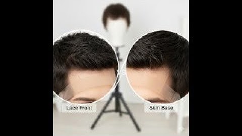 Review bộ đế tóc giả, cách trị tóc rụng, rụng tóc từng mảng, cách trị hói không phẫu thuật