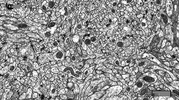 Elastic ssTEM alignment, neuropil Dros. mel. larva 1