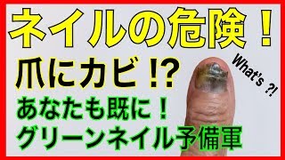 グリーンネイルになりました！早期発見が大切！対処法と対策と原因！