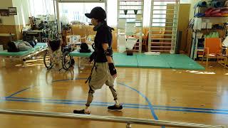 Bilateral above knee prosthetics  rehabilitation 両足大腿義足のリハビリ　歩容矯正ギプスつき