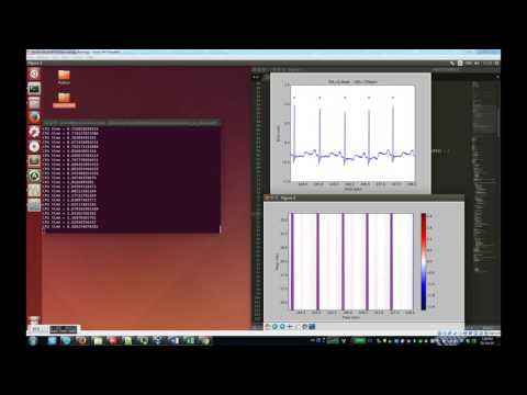 Plotting Python Continuous Wavelet  transform on MIT DB 14.75-18.25 Hz