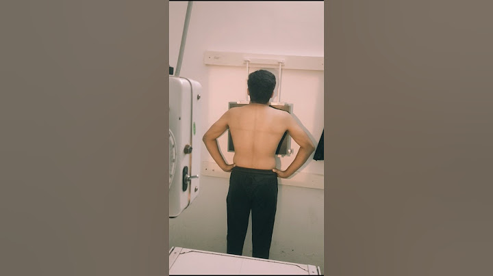 CHEST PA XRAY #radiology #radiologist #radiographer #medical #trending #shorts #2024 #love #life #2k