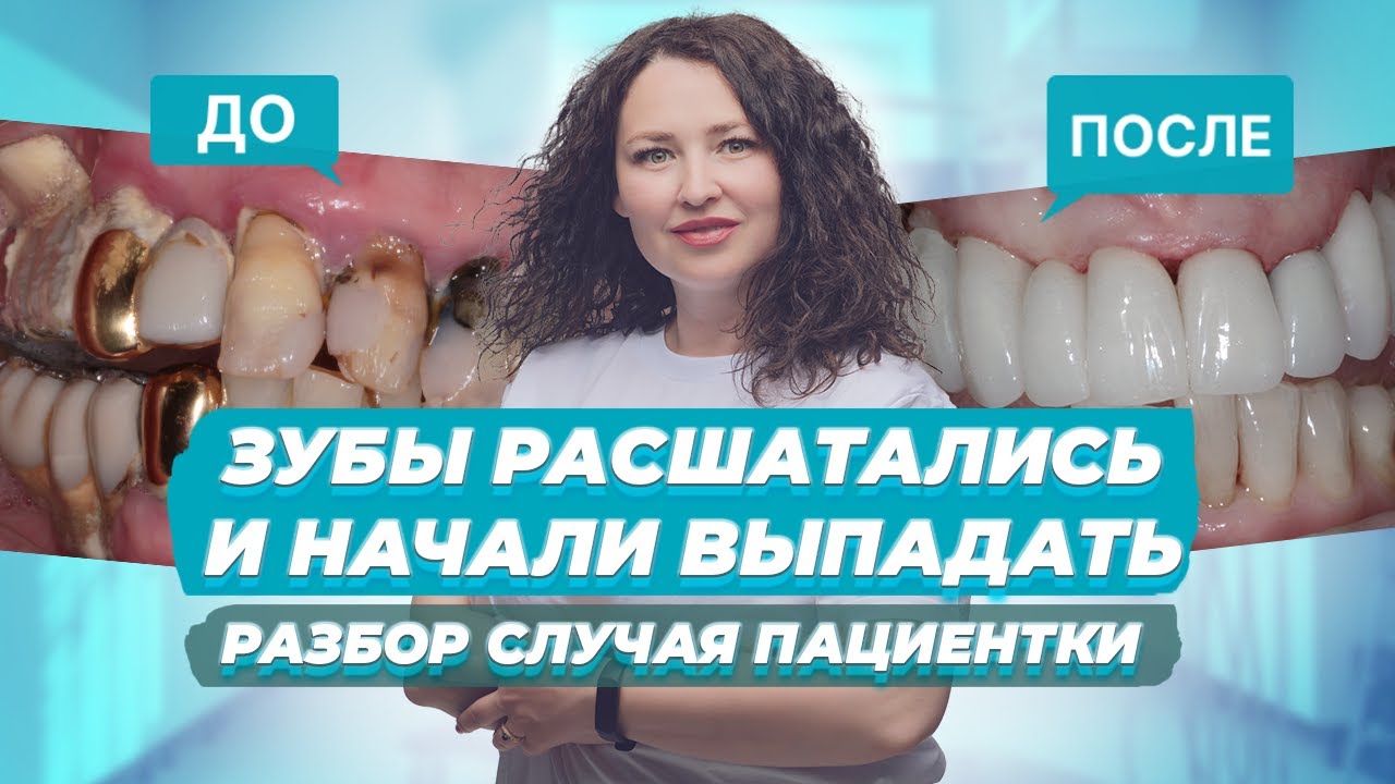 У вас расшатались зубы? Как лечить запущенный пародонтит ...