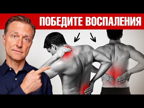 10 причин воспаления в организме. 11 способов восстановления. ✅