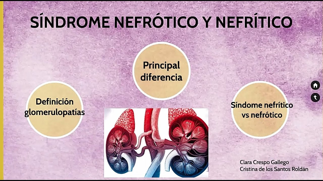 Diferencias entre el Síndrome Nefrótico y Nefrítico - YouTube