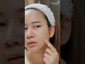Why Your Skin Gets Worse in Summer 🌞 #acne #skincare #summer