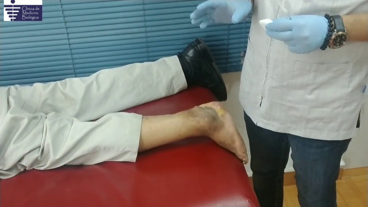 PIE DIABÉTICO. Tratamiento y testimonio, Clínica de medicina biológica