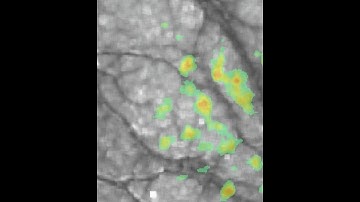 Speckle-Based Functional Brain Response: Whisker Stimulation
