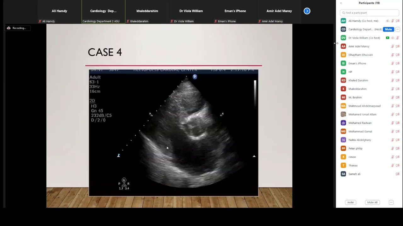 Transthoracic Echo Cases   Dr  Viola William