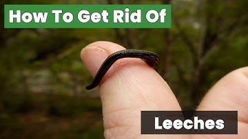 How To Get Rid Of Leeches With This Simple Trick!