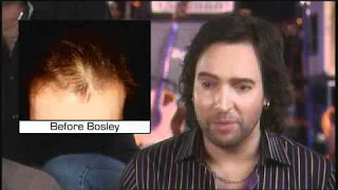 Musician Jerry Lopez Bosley Hair Transplant Testim...