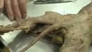Professor Fink Reviews the CAT Posterior Muscles of the Leg (4); Anatomy dissection Professor Fink Reviews the CAT Posterior Muscles of the Leg (4); Anatomy dissection