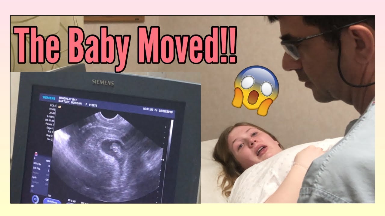 first prenatal visit at 8 weeks ultrasound