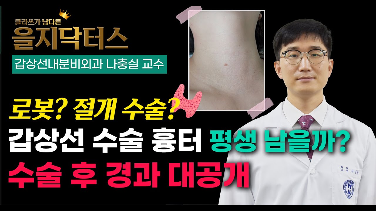 목 흉터 걱정 없이 갑상선암 수술 받는 법? 갑상선 수술 흉터 회복 리얼 후기 (갑상선내분비외과 나충실 교수)