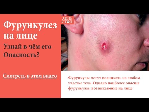 Видео: Молитва от фурункулов на лице