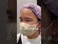 【二重整形】中学1年の夏休み 初めての二重整形　#shorts