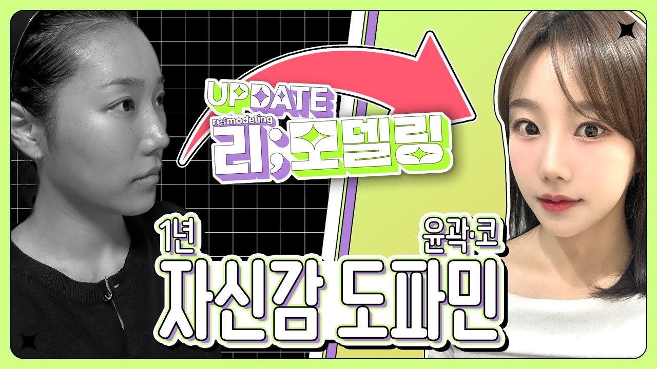 윤곽3종+코재수술 자신감 도파민 UP! ㅣ비티성형외과