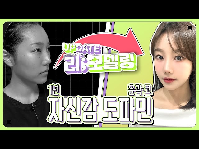 윤곽3종+코재수술 자신감 도파민 UP! ㅣ비티성형외과