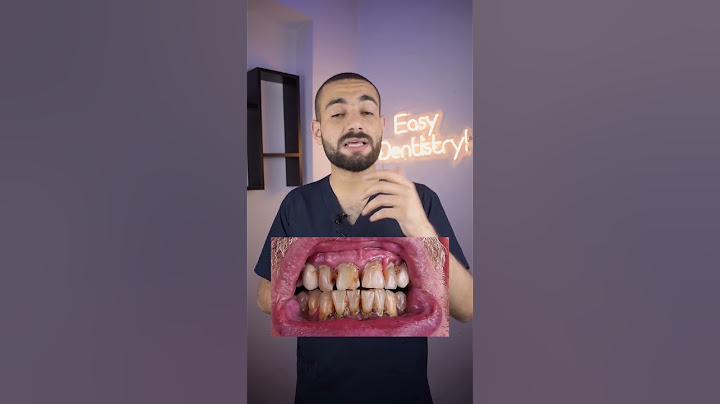اكتر حد ممكن يكشف متعاطي المخدرات! ٥ علامات واضحه 👌🏼