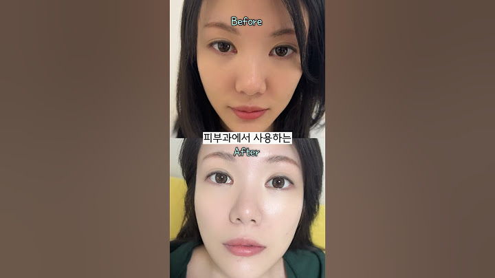 연예인들은 어렸을 땐 이렇게 피부가 까맸는데 지금은 하얀이유 #kbeauty #후기 #미백 #미백크림
