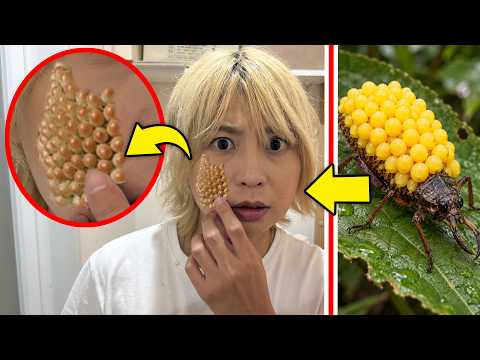【閲覧注意】謎の虫に噛まれて顔が病気になりました・・・