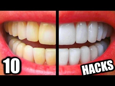 10 Simple Life Hacks For Teeth Whitening Everyone Should Know! DIY Teeth Whitening Hacks!