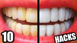10 Simple Life Hacks For Teeth Whitening Everyone Should Know! DIY Teeth Whitening Hacks!