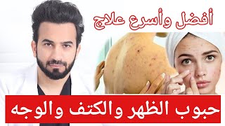 علاج حبوب الظهر والكتف والصدر والوجه