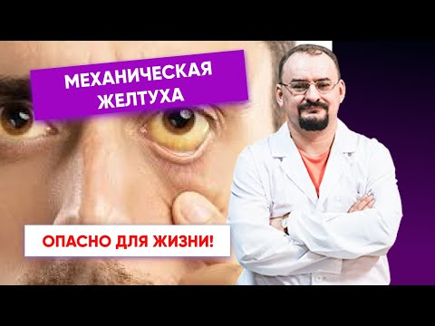 Механическая желтуха - объяснение этого состояния от доктора Голода.