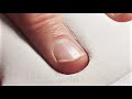 One Year Time Lapse of Growing-Trimming Fingernail