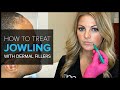 FAQ: Bay Area Expert Shows How to Treat Jowls with Dermal Fillers