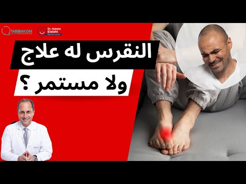 هل يمكن الشفاء من النقرس أم أنه مرض مزمن د حاتم العيشي استاذ الروماتيزم