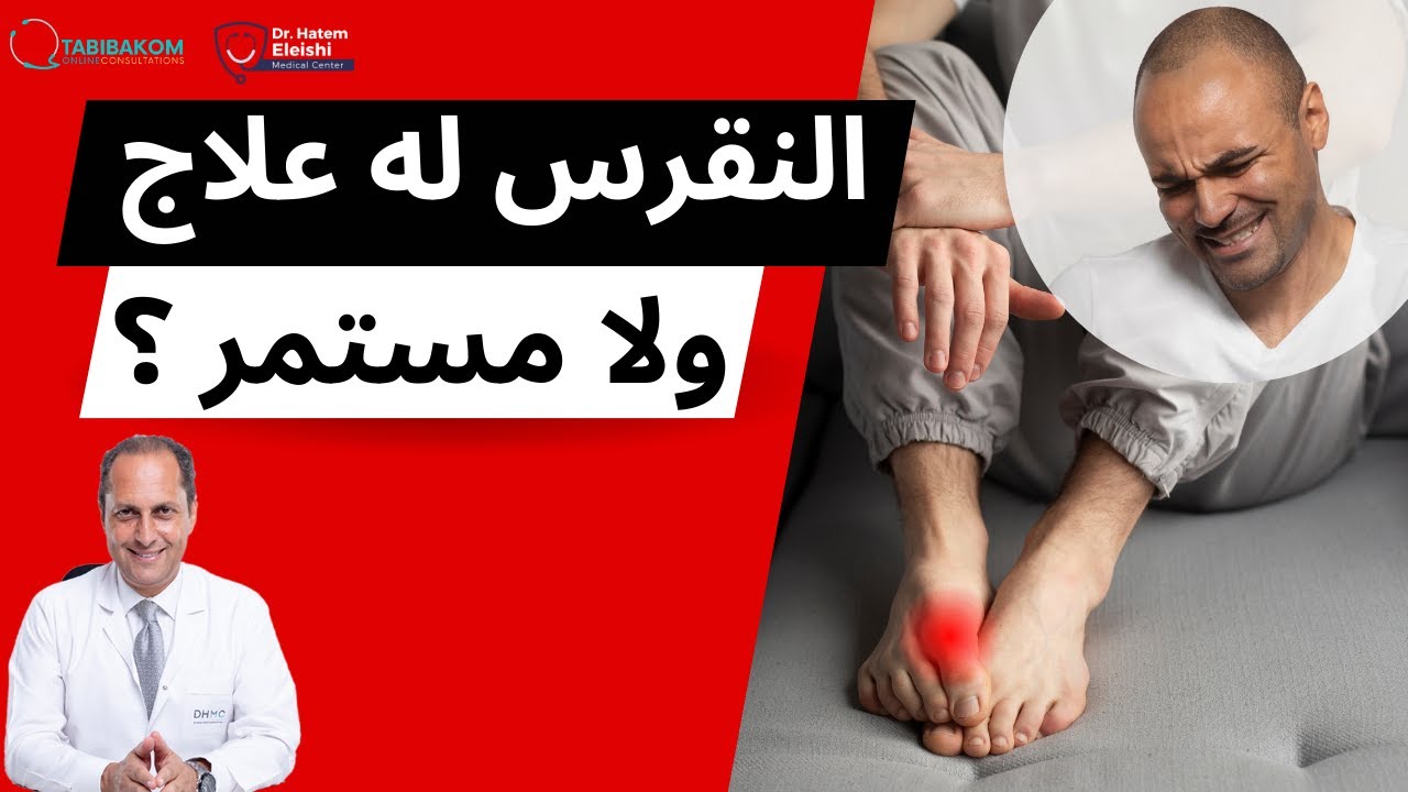 هل يمكن الشفاء من النقرس أم أنه مرض مزمن؟ د. حاتم العيشي استاذ الروماتيزم