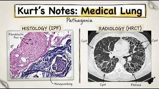 Kurt’s Notes: Medical Lung #pathagonia
