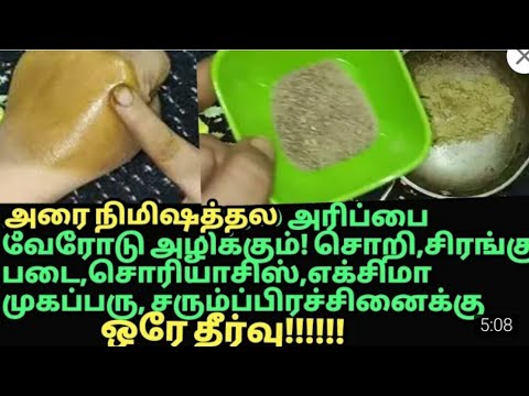 அரிப்பு! அரிப்பு!அரிப்பு இத்தனை நாள் இது தெரியாமப்போச்சே! itching,psoriasis,skin disease home remedy