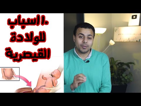 فيديو: لماذا تحتاجين طبيب توليد؟