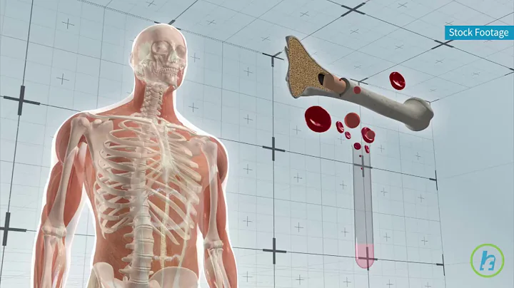 Potential Treatment for Bone Marrow Disorders