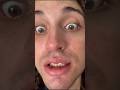 ti farò *GRATTARE* il NASO!🤯🫵 #giox97 #shorts #fortnite #brainrot #risate #challenge #ps5 #short
