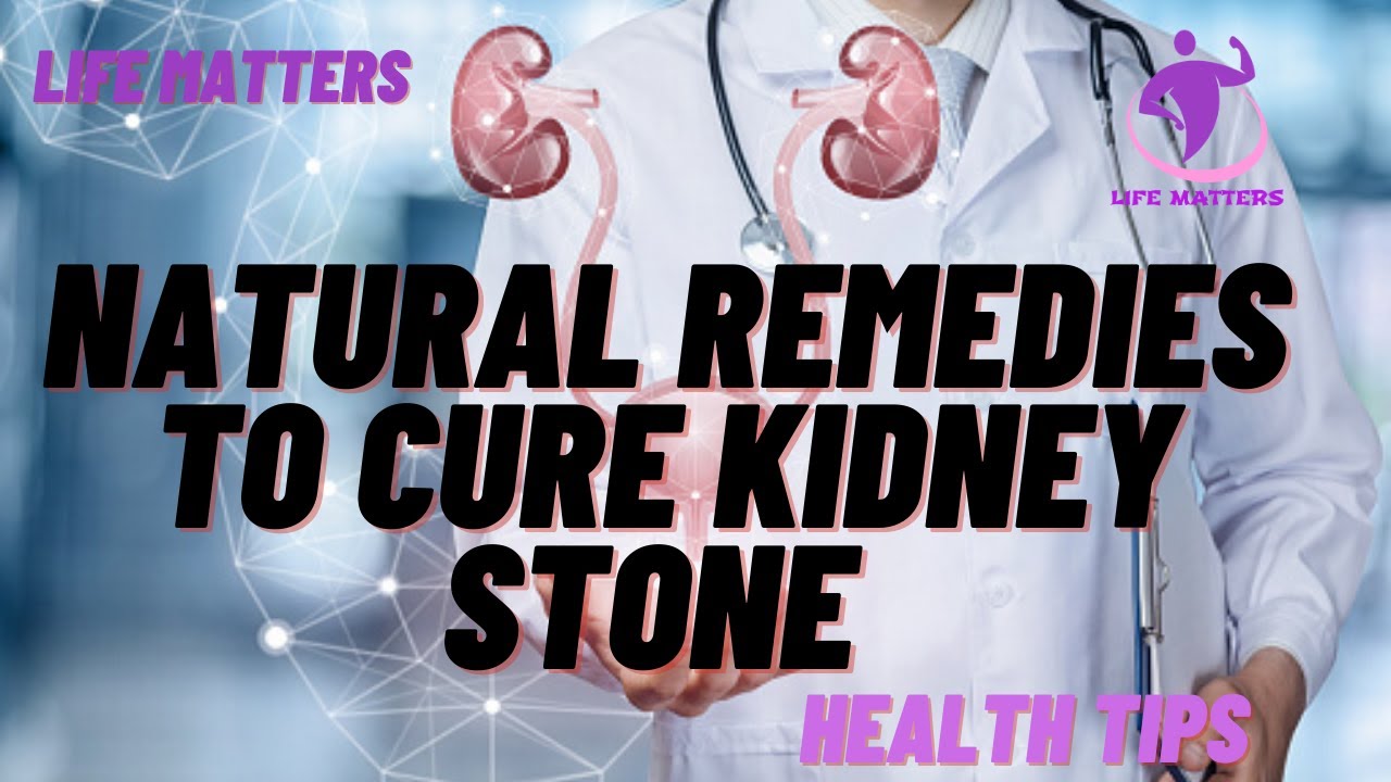 NATURAL REMEDIES TO CURE KIDNEY STONE