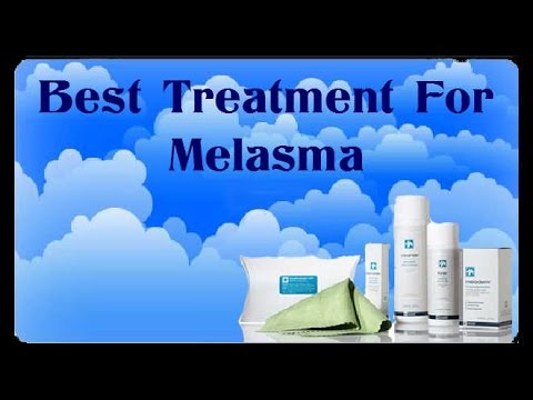 What is the best treatment for melasma?