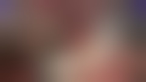 Robot Assisted Management of Complex Choledocholithiasis Using Holimum Laser