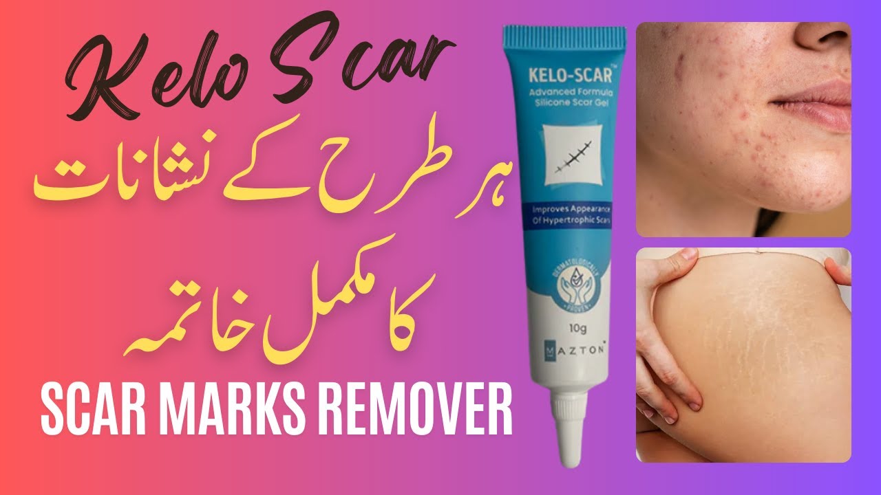 Kelo Scar | Silicone Gel For Scars | Scar Marks Removal Cream In Pakistan