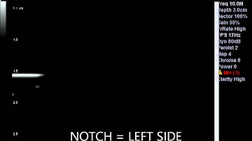 UltraSound Visualization