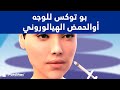 © بو توكس للوجه أوالحمض الهيالوروني - علاج تجاعيد الوجه