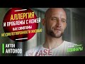 Аллергия и проблемы с кожей как симптомы неудовлетворенности жизнью. Антон Антонов