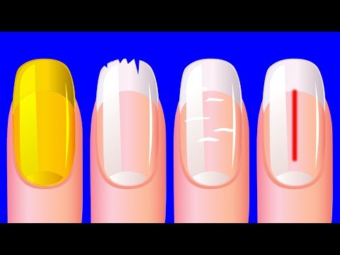 Vídeo: O Que Essas 8 Texturas E Cores Das Unhas Dizem Sobre Sua Saúde