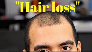 Transform A Bald Guy To A Model | 2020