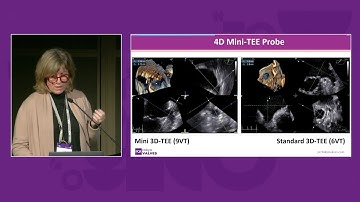 Sharper views, smarter moves: mini 4D TEE and 4D ICE in structural heart interventions